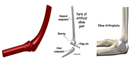 Elbow Joint