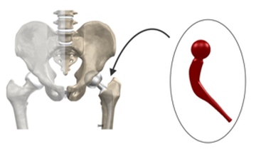 Hip Joint